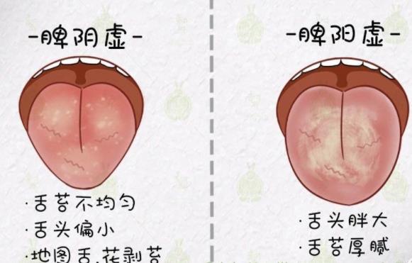 阴虚和阳虚最简单辨别，阳虚和阴虚最正确的判断方法