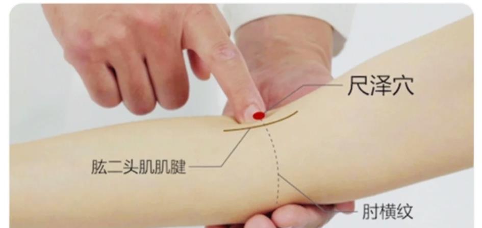 尺泽穴的准确位置，尺泽穴最笨取穴方法图